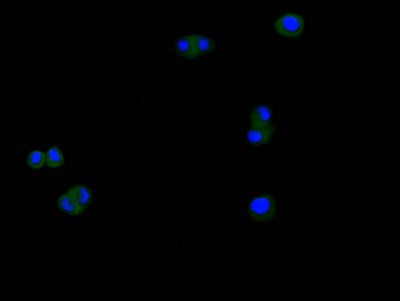 Immunofluorescence staining of Hela cell with CTNNB1 Recombinant Monoclonal Antibody at 1:200, counter-stained with DAPI. The cells were fixed in 4% formaldehyde and blocked in 10% normal Goat Serum. The cells were then incubated with the antibody overnight at 4C. The secondary antibody was Alexa Fluor 488-congugated AffiniPure Goat Anti-rabbit IgG(H+L).