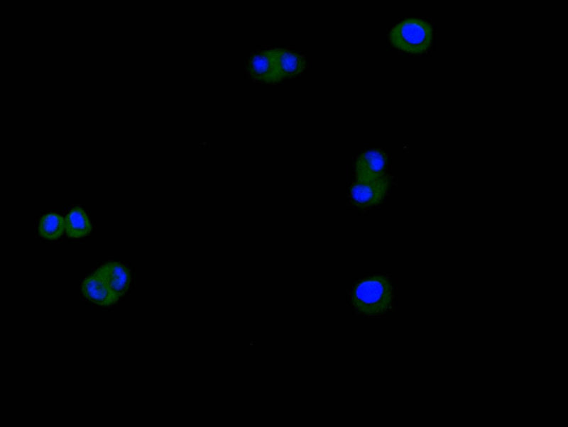 Immunofluorescence staining of Hela cell with CTNNB1 Recombinant Monoclonal Antibody at 1:200, counter-stained with DAPI. The cells were fixed in 4% formaldehyde and blocked in 10% normal Goat Serum. The cells were then incubated with the antibody overnight at 4C. The secondary antibody was Alexa Fluor 488-congugated AffiniPure Goat Anti-rabbit IgG(H+L).