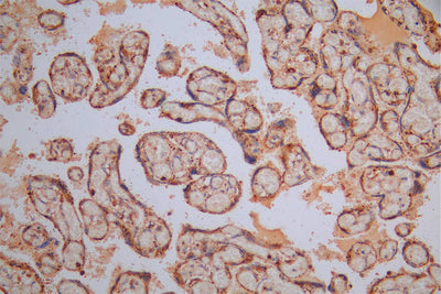 IHC image of CTSL Recombinant Monoclonal Antibody diluted at 1:30 and staining in paraffin-embedded human placenta tissue performed on a Leica BondTM system. After dewaxing and hydration, antigen retrieval was mediated by high pressure in a citrate buffer (pH 6.0). Section was blocked with 10% normal goat serum 30min at RT. Then primary antibody (1% BSA) was incubated at 4°C overnight. The primary is detected by a Goat anti-Mouse IgG labeled by HRP and visualized using 0.05% DAB.