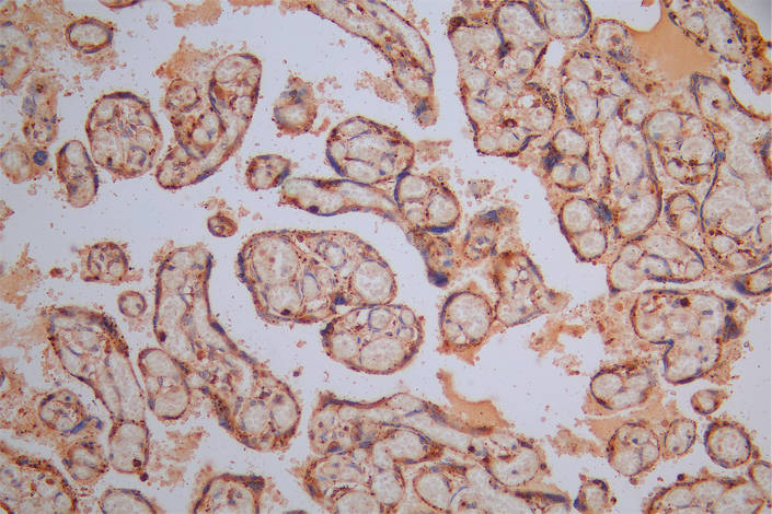 IHC image of CTSL Recombinant Monoclonal Antibody diluted at 1:30 and staining in paraffin-embedded human placenta tissue performed on a Leica BondTM system. After dewaxing and hydration, antigen retrieval was mediated by high pressure in a citrate buffer (pH 6.0). Section was blocked with 10% normal goat serum 30min at RT. Then primary antibody (1% BSA) was incubated at 4°C overnight. The primary is detected by a Goat anti-Mouse IgG labeled by HRP and visualized using 0.05% DAB.