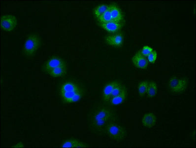 Immunofluorescence staining of HepG2 cells with CYP19A1 Recombinant Monoclonal Antibody at 1:76, counter-stained with DAPI. The cells were fixed in 4% formaldehyde, permeabilized using 0.2% Triton X-100 and blocked in 10% normal Goat Serum. The cells were then incubated with the antibody overnight at 4℃. The secondary antibody was Alexa Fluor 488-congugated AffiniPure Goat Anti-Rabbit IgG (H+L).