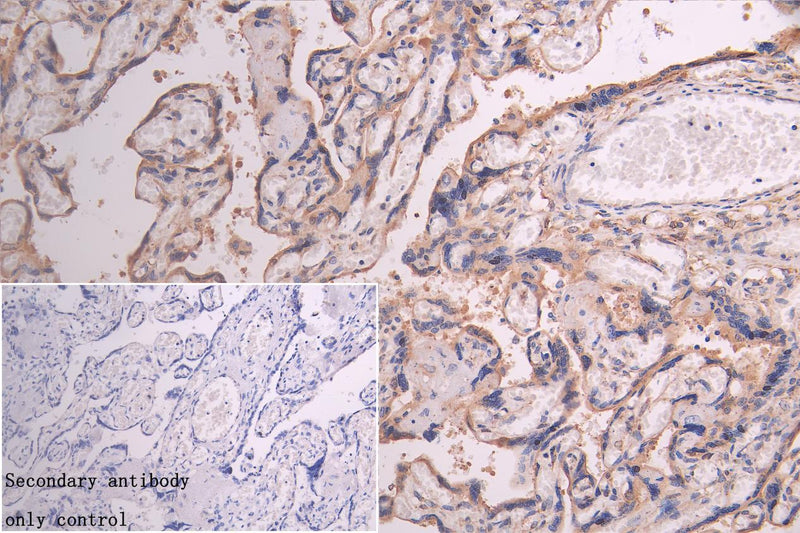 IHC image of CYP19A1 Recombinant Monoclonal Antibody diluted at 1:230 and staining in paraffin-embedded human placenta tissue performed on a Leica BondTM system. After dewaxing and hydration, antigen retrieval was mediated by high pressure in a citrate buffer (pH 6.0). Section was blocked with 10% normal goat serum 30min at RT. Then primary antibody (1% BSA) was incubated at 4℃ overnight. The primary is detected by a biotinylated secondary antibody and visualized using an HRP conjugated SP system.