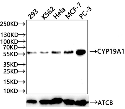 Western Blot | Positive WB detected in: HepG2 whole cell lysate, Jurkat whole cell lysate, 293 whole cell lysate, SH-SY5Y whole cell lysate, U87 whole cell lysate, K562 whole cell lysate | All lanes: CYP19A1 antibody at 2.3μg/ml | Secondary | Goat polyclonal to rabbit IgG at 1/50000 dilution | Predicted band size: 58, 25 KDa | Observed band size: 58 KDa