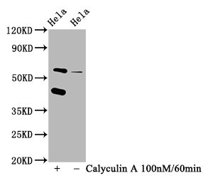 Western Blot | Positive WB detected in Hela whole cell lysate(treated with Calyculin A or not) | All lanes Phospho-EIF2AK2 antibody at 1.25μg/ml | Secondary | Goat polyclonal to rabbit IgG at 1/50000 dilution | Predicted band size: 62 KDa | Observed band size: 62 KDaPhospho-EIF2AK2 (T446) Recombinant Monoclonal Antibody