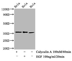 Western Blot | Positive WB detected in Hela whole cell lysate(treated with Calyculin A or EGF)  | All lanes Phospho-EIF2S1 antibody at 1.48μg/ml | Secondary | Goat polyclonal to rabbit IgG at 1/50000 dilution | Predicted band size: 36 KDa | Observed band size: 36 KDaPhospho-EIF2S1 (S51) Recombinant Monoclonal Antibody