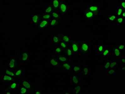 Immunofluorescence staining of Hela cells with FEN1 Recombinant Monoclonal Antibody at 1:25, counter-stained with DAPI. The cells were fixed in 4% formaldehyde, permeabilized using 0.2% Triton X-100 and blocked in 10% normal Goat Serum. The cells were then incubated with the antibody overnight at 4℃. The secondary antibody was Alexa Fluor 488-congugated AffiniPure Goat Anti-Rabbit IgG (H+L).FEN1 Recombinant Monoclonal Antibody