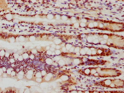 IHC image of FEN1 Recombinant Monoclonal Antibody diluted at 1:77.5 and staining in paraffin-embedded human small intestine tissue performed on a Leica BondTM system. After dewaxing and hydration, antigen retrieval was mediated by high pressure in a citrate buffer (pH 6.0). Section was blocked with 10% normal goat serum 30min at RT. Then primary antibody (1% BSA) was incubated at 4℃ overnight. The primary is detected by a biotinylated secondary antibody and visualized using an HRP conjugated SP system.FEN1 Recombinant Monoclonal Antibody