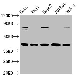 Western Blot | Positive WB detected in: Hela whole cell lysate, Raji whole cell lysate, HepG2 whole cell lysate, Jurkat whole cell lysate, MCF-7 whole cell lysate | All lanes: FEN1 antibody at 0.775μg/ml | Secondary | Goat polyclonal to rabbit IgG at 1/50000 dilution | Predicted band size: 43, 36 KDa | Observed band size: 43 KDaFEN1 Recombinant Monoclonal Antibody