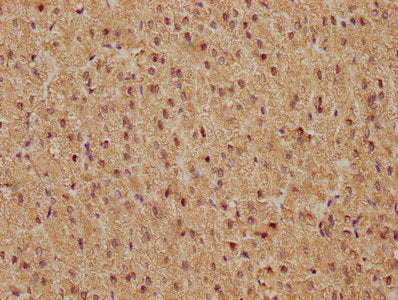 IHC image of FOS Recombinant Monoclonal Antibody diluted at 1:81 and staining in paraffin-embedded human adrenal gland tissue performed on a Leica BondTM system. After dewaxing and hydration, antigen retrieval was mediated by high pressure in a citrate buffer (pH 6.0). Section was blocked with 10% normal goat serum 30min at RT. Then primary antibody (1% BSA) was incubated at 4℃ overnight. The primary is detected by a biotinylated secondary antibody and visualized using an HRP conjugated SP system.FOS Recombinant Monoclonal Antibody