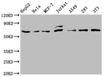 Western Blot | Positive WB detected in: HepG2 whole cell lysate, Hela whole cell lysate, MCF-7 whole cell lysate, Jurkat whole cell lysate, A549 whole cell lysate, 293 whole cell lysate, NIH/3T3 whole cell lysate | All lanes: c-FOS antibody at 0.81μg/ml | Secondary | Goat polyclonal to rabbit IgG at 1/50000 dilution | Predicted band size: 41, 29, 37 KDa | Observed band size: 62 KDaFOS Recombinant Monoclonal Antibody