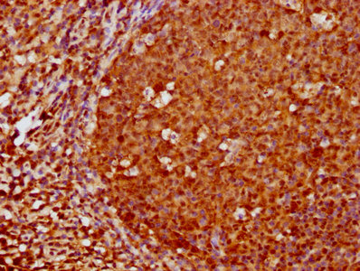 IHC image of FOXO3 Recombinant Monoclonal Antibody diluted at 1:180 and staining in paraffin-embedded human tonsil tissue performed on a Leica BondTM system. After dewaxing and hydration, antigen retrieval was mediated by high pressure in a citrate buffer (pH 6.0). Section was blocked with 10% normal goat serum 30min at RT. Then primary antibody (1% BSA) was incubated at 4℃ overnight. The primary is detected by a biotinylated secondary antibody and visualized using an HRP conjugated SP system.FOXO3 Recombinant Monoclonal Antibody