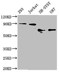 Western Blot | Positive WB detected in: 293 whole cell lysate, Jurkat whole cell lysate, SH-SY5Y whole cell lysate, U87 whole cell lysate | All lanes: FOXO3A antibody at 1.8μg/ml | Secondary | Goat polyclonal to rabbit IgG at 1/50000 dilution | Predicted band size: 72, 49 KDa | Observed band size: 72-90 KDaFOXO3 Recombinant Monoclonal Antibody
