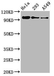 Western Blot | Positive WB detected in Hela whole cell lysate, 293 whole cell lysate, A549 whole cell lysate | All lanes Phospho-FOXO3 antibody at 0.96μg/ml | Secondary | Goat polyclonal to rabbit IgG at 1/50000 dilution | Predicted band size: 97 KDa | Observed band size: 97 KDaPhospho-FOXO3 (S253) Recombinant Monoclonal Antibody