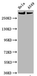 Western Blot | Positive WB detected in Hela whole cell lysate,A549 whole cell lysate | All lanes Phospho-MTOR antibody at 0.825μg/ml | Secondary | Goat polyclonal to rabbit IgG at 1/50000 dilution | Predicted band size: 289 KDa | Observed band size: 289 KDaPhospho-MTOR (S2448) Recombinant Monoclonal Antibody
