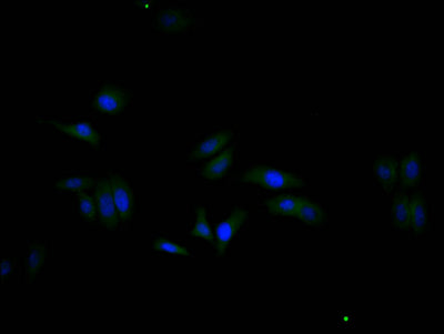 Immunofluorescence staining of HepG2 cell with GAPDH Recombinant Monoclonal Antibody at 1:20, counter-stained with DAPI. The cells were fixed in 4% formaldehyde and blocked in 10% normal Goat Serum. The cells were then incubated with the antibody overnight at 4C. The secondary antibody was Alexa Fluor 488-congugated AffiniPure Goat Anti-Rabbit IgG(H+L).GAPDH Recombinant Monoclonal Antibody