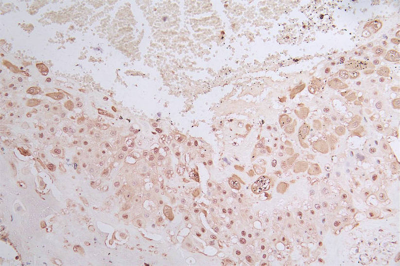 IHC image of GAPDH Recombinant Monoclonal Antibody diluted at 1:50 and staining in paraffin-embedded human placenta tissue performed on a Leica BondTM system. After dewaxing and hydration, antigen retrieval was mediated by high pressure in a citrate buffer (pH 6.0). Section was blocked with 10% normal goat serum 30min at RT. Then primary antibody (1% BSA) was incubated at 4°C overnight. The primary is detected by a Goat anti-rabbit polymer IgG labeled by HRP and visualized using 0.05% DAB.GAPDH Recombinant Monoclonal Antibody