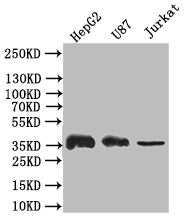 Western Blot | Positive WB detected in: HepG2 whole cell lysate,U87 whole cell lysate,JK whole cell lysate | All lanes: GAPDH antibody at 1:500 | Secondary | Goat polyclonal to rabbit IgG at 1/50000 dilution | Predicted band size: 36 kDa | Observed band size: 36 kDaGAPDH Recombinant Monoclonal Antibody