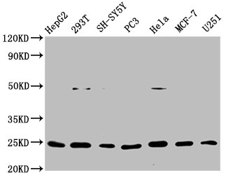 Western Blot | Positive WB detected in: HepG2 whole cell lysate, 293T whole cell lysate, SH-SY5Y whole cell lysate, PC3 whole cell lysate, Hela whole cell lysate, MCF-7 whole cell lysate, U251 whole cell lysate | All lanes: GDNF antibody at 1μg/ml | Secondary | Goat polyclonal to rabbit IgG at 1/50000 dilution | Predicted band size: 24, 21, 26, 23, 19 KDa | Observed band size: 24 KDaGDNF Recombinant Monoclonal Antibody