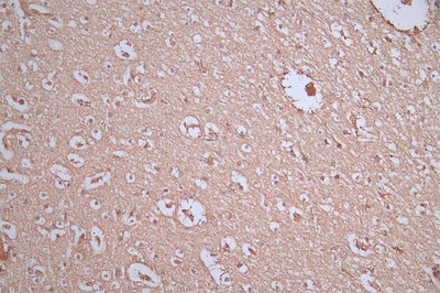 IHC image of GFAP Recombinant Monoclonal Antibody diluted at 1:300 and staining in paraffin-embedded human brain tissue performed on a Leica BondTM system. After dewaxing and hydration, antigen retrieval was mediated by high pressure in a citrate buffer (pH 6.0). Section was blocked with 10% normal goat serum 30min at RT. Then primary antibody (1% BSA) was incubated at 4°C overnight. The primary is detected by a Goat anti-Mouse IgG labeled by HRP and visualized using 0.05% DAB.GFAP Recombinant Monoclonal Antibody