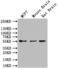 Western Blot | Positive WB detected in: MCF7 whole cell lysate,Mouse Brain tissue lysate,Rat Brain tissue lysate | All lanes: GFAP antibody at 1:1000 | Secondary | Goat polyclonal to mouse IgG at 1/50000 dilution | Predicted band size: 50 kDa | Observed band size: 55 kDaGFAP Recombinant Monoclonal Antibody