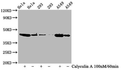 Western Blot | Positive WB detected in Hela whole cell lysate,293 whole cell lysate,A549 whole cell lysate(treated with Calyculin A or not) | All lanes Phospho-GSK3B antibody at 0.77μg/ml | Secondary | Goat polyclonal to rabbit IgG at 1/50000 dilution | Predicted band size: 46 KDa | Observed band size: 46 KDaPhospho-GSK3B (Ser9) Recombinant Monoclonal Antibody