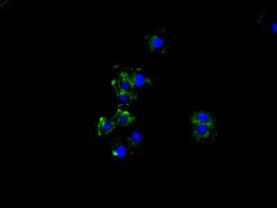 Immunofluorescence staining of hela cell with GSN Recombinant Monoclonal Antibody at 1:50, counter-stained with DAPI. The cells were fixed in 4% formaldehyde and blocked in 10% normal Goat Serum. The cells were then incubated with the antibody overnight at 4C. The secondary antibody was FITC-conjugated AffiniPure Goat Anti-Rabbit IgG(H+L).GSN Recombinant Monoclonal Antibody