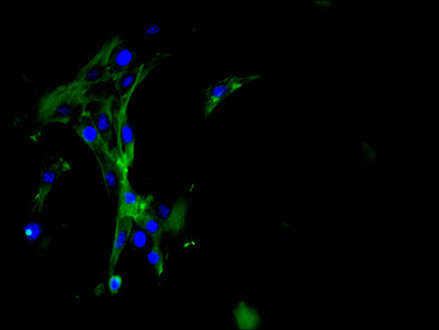 Immunofluorescence staining of NIH/3T3 cell with GSN Recombinant Monoclonal Antibody at 1:50, counter-stained with DAPI. The cells were fixed in 4% formaldehyde and blocked in 10% normal Goat Serum. The cells were then incubated with the antibody overnight at 4C. The secondary antibody was FITC-conjugated AffiniPure Goat Anti-Rabbit IgG(H+L).GSN Recombinant Monoclonal Antibody