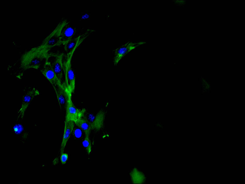 Immunofluorescence staining of NIH/3T3 cell with GSN Recombinant Monoclonal Antibody at 1:50, counter-stained with DAPI. The cells were fixed in 4% formaldehyde and blocked in 10% normal Goat Serum. The cells were then incubated with the antibody overnight at 4C. The secondary antibody was FITC-conjugated AffiniPure Goat Anti-Rabbit IgG(H+L).GSN Recombinant Monoclonal Antibody