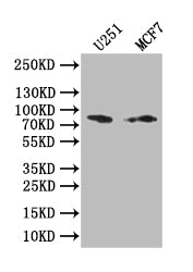 Western Blot | Positive WB detected in: U251 whole cell lysate, MCF7 whole cell lysate | All lanes: GSN antibody at 1:1000 | Secondary | Goat polyclonal to rabbit IgG at 1/50000 dilution | Predicted band size: 85 kDa | Observed band size: 85 kDaGSN Recombinant Monoclonal Antibody