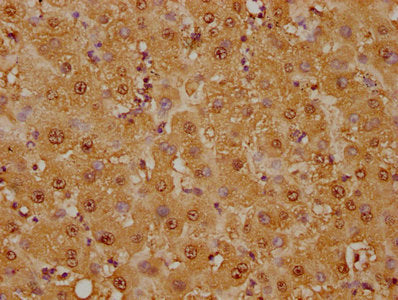 IHC image of GSTO1 Recombinant Monoclonal Antibody diluted at 1:125 and staining in paraffin-embedded human liver tissue performed on a Leica BondTM system. After dewaxing and hydration, antigen retrieval was mediated by high pressure in a citrate buffer (pH 6.0). Section was blocked with 10% normal goat serum 30min at RT. Then primary antibody (1% BSA) was incubated at 4℃ overnight. The primary is detected by a biotinylated secondary antibody and visualized using an HRP conjugated SP system.GSTO1 Recombinant Monoclonal Antibody
