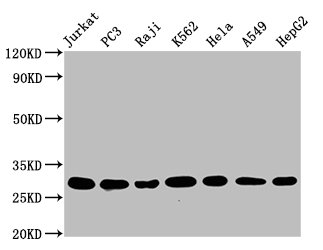 Western Blot | Positive WB detected in: Jurkat whole cell lysate, PC3 whole cell lysate, Raji whole cell lysate, K562 whole cell lysate, Hela whole cell lysate, A549 whole cell lysate, HepG2 whole cell lysate | All lanes: GSTO1 antibody at 1.25μg/ml | Secondary | Goat polyclonal to rabbit IgG at 1/50000 dilution | Predicted band size: 28, 24, 25 KDa | Observed band size: 28 KDaGSTO1 Recombinant Monoclonal Antibody