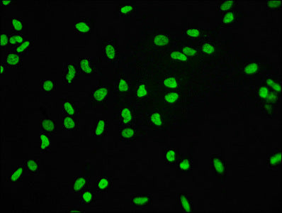 Immunofluorescence staining of Hela cells with Histone H3.3 Recombinant Monoclonal Antibody at 1:60,counter-stained with DAPI. The cells were fixed in 4% formaldehyde, permeabilized using 0.2% Triton X-100 and blocked in 10% normal Goat Serum. The cells were then incubated with the antibody overnight at 4℃.The secondary antibody was Alexa Fluor 488-congugated AffiniPure Goat Anti-Rabbit IgG (H+L).Histone H3.3 Recombinant Monoclonal Antibody