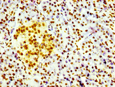 IHC image of the antibody diluted at 1:100 and staining in paraffin-embedded human pancreatic tissue performed on a Leica BondTM system. After dewaxing and hydration, antigen retrieval was mediated by high pressure in a citrate buffer (pH 6.0). Section was blocked with 10% normal goat serum 30min at RT. Then primary antibody (1% BSA) was incubated at 4℃ overnight. The primary is detected by a biotinylated secondary antibody and visualized using an HRP conjugated SP system.Histone H3.3 Recombinant Monoclonal Antibody