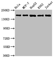 Western Blot | Positive WB detected in: Hela whole cell lysate, MCF-7 whole cell lysate, HepG2 whole cell lysate, K562 whole cell lysate, Jurkat whole cell lysate | All lanes: HDAC6 antibody at 1.1μg/ml | Secondary | Goat polyclonal to rabbit IgG at 1/50000 dilution | Predicted band size: 132, 115 KDa | Observed band size: 160 KDaHDAC6 Recombinant Monoclonal Antibody