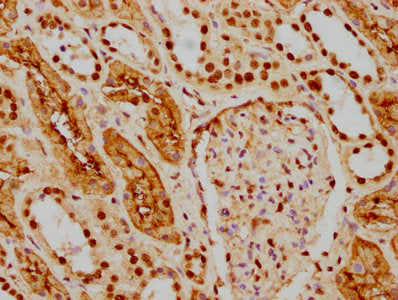 IHC image of HDAC9 Recombinant Monoclonal Antibody diluted at 1:154 and staining in paraffin-embedded human kidney tissue performed on a Leica BondTM system. After dewaxing and hydration, antigen retrieval was mediated by high pressure in a citrate buffer (pH 6.0). Section was blocked with 10% normal goat serum 30min at RT. Then primary antibody (1% BSA) was incubated at 4℃ overnight. The primary is detected by a biotinylated secondary antibody and visualized using an HRP conjugated SP system.HDAC9 Recombinant Monoclonal Antibody