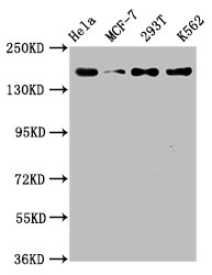 Western Blot | Positive WB detected in: Hela whole cell lysate, MCF-7 whole cell lysate, 293T whole cell lysate, K562 whole cell lysate | All lanes: HDAC9 antibody at 1.54μg/ml | Secondary | Goat polyclonal to rabbit IgG at 1/50000 dilution | Predicted band size: 112, 102, 66, 98, 118, 113, 61, 63, 58 KDa | Observed band size: 160 KDaHDAC9 Recombinant Monoclonal Antibody