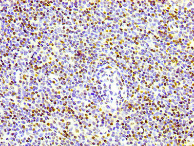 IHC image of the antibody diluted at 1:100 and staining in paraffin-embedded human lymph node tissue performed on a Leica BondTM system. After dewaxing and hydration, antigen retrieval was mediated by high pressure in a citrate buffer (pH 6.0). Section was blocked with 10% normal goat serum 30min at RT. Then primary antibody (1% BSA) was incubated at 4℃ overnight. The primary is detected by a biotinylated secondary antibody and visualized using an HRP conjugated SP system.Phospho-Histone H1.4 (T17) Recombinant Monoclonal Antibody
