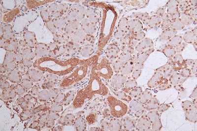 IHC image of HIST1H3A Recombinant Monoclonal Antibody diluted at 1:300 and staining in paraffin-embedded human salivary gland tissue performed on a Leica BondTM system. After dewaxing and hydration, antigen retrieval was mediated by high pressure in a citrate buffer (pH 6.0). Section was blocked with 10% normal goat serum 30min at RT. Then primary antibody (1% BSA) was incubated at 4°C overnight. The primary is detected by a Goat anti-Mouse IgG labeled  by HRP and visualized using 0.05% DAB.HIST1H3A Recombinant Monoclonal Antibody