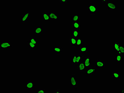 Immunofluorescence staining of Hela cells(treated by 15mM sodium butyrate for 30min) with Acetyl-Histone H4 (K5) Recombinant Monoclonal Antibody at 1:65,counter-stained with DAPI. The cells were fixed in 4% formaldehyde, permeabilized using 0.2% Triton X-100 and blocked in 10% normal Goat Serum. The cells were then incubated with the antibody overnight at 4℃.The secondary antibody was Alexa Fluor 488-congugated AffiniPure Goat Anti-Rabbit IgG (H+L).Acetyl-Histone H4 (K5) Recombinant Monoclonal Antibody
