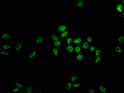 Immunofluorescence staining of Hela cells with HNRNPC Recombinant Monoclonal Antibody at 1:22, counter-stained with DAPI. The cells were fixed in 4% formaldehyde, permeabilized using 0.2% Triton X-100 and blocked in 10% normal Goat Serum. The cells were then incubated with the antibody overnight at 4℃. The secondary antibody was Alexa Fluor 488-congugated AffiniPure Goat Anti-Rabbit IgG (H+L).HNRNPC Recombinant Monoclonal Antibody