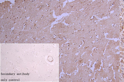 IHC image of HNRNPC Recombinant Monoclonal Antibody diluted at 1:66.35 and staining in paraffin-embedded human kidney tissue performed on a Leica BondTM system. After dewaxing and hydration, antigen retrieval was mediated by high pressure in a citrate buffer (pH 6.0). Section was blocked with 10% normal goat serum 30min at RT. Then primary antibody (1% BSA) was incubated at 4℃ overnight. The primary is detected by a biotinylated secondary antibody and visualized using an HRP conjugated SP system.HNRNPC Recombinant Monoclonal Antibody