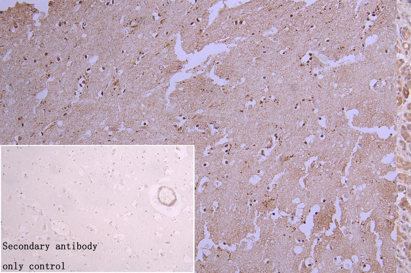 IHC image of HNRNPC Recombinant Monoclonal Antibody diluted at 1:66.35 and staining in paraffin-embedded human kidney tissue performed on a Leica BondTM system. After dewaxing and hydration, antigen retrieval was mediated by high pressure in a citrate buffer (pH 6.0). Section was blocked with 10% normal goat serum 30min at RT. Then primary antibody (1% BSA) was incubated at 4℃ overnight. The primary is detected by a biotinylated secondary antibody and visualized using an HRP conjugated SP system.HNRNPC Recombinant Monoclonal Antibody
