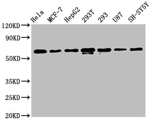 Western Blot | Positive WB detected in: Hela whole cell lysate, MCF-7 whole cell lysate, HepG2 whole cell lysate, 293T whole cell lysate, 293 whole cell lysate, U87 whole cell lysate, SH-SY5Y whole cell lysate | All lanes: HNRNPK antibody at 1.3μg/ml | Secondary | Goat polyclonal to rabbit IgG at 1/50000 dilution | Predicted band size: 51, 52, 49 KDa | Observed band size: 60 KDaHNRNPK Recombinant Monoclonal Antibody
