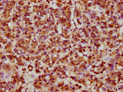 IHC image of HSPB1 Recombinant Monoclonal Antibody diluted at 1:61.9 and staining in paraffin-embedded human pancreatic tissue performed on a Leica BondTM system. After dewaxing and hydration, antigen retrieval was mediated by high pressure in a citrate buffer (pH 6.0). Section was blocked with 10% normal goat serum 30min at RT. Then primary antibody (1% BSA) was incubated at 4℃ overnight. The primary is detected by a biotinylated secondary antibody and visualized using an HRP conjugated SP system.