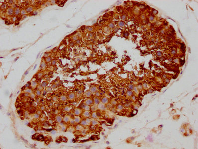 IHC image of HSP90AA1 Recombinant Monoclonal Antibody diluted at 1:80 and staining in paraffin-embedded human testis tissue performed on a Leica BondTM system. After dewaxing and hydration, antigen retrieval was mediated by high pressure in a citrate buffer (pH 6.0). Section was blocked with 10% normal goat serum 30min at RT. Then primary antibody (1% BSA) was incubated at 4℃ overnight. The primary is detected by a biotinylated secondary antibody and visualized using an HRP conjugated SP system.HSP90AA1 Recombinant Monoclonal Antibody