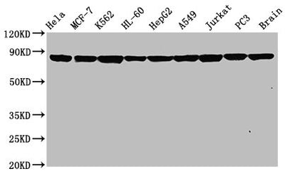 Western Blot | Positive WB detected in: Hela whole cell lysate, MCF-7 whole cell lysate, K562 whole cell lysate, HL-60 whole cell lysate, HepG2 whole cell lysate, A549 whole cell lysate, Jurkat whole cell lysate, PC3 whole cell lysate, Rat brain tissue | All lanes: Hsp90 alpha antibody at 0.8μg/ml | Secondary | Goat polyclonal to rabbit IgG at 1/50000 dilution | Predicted band size: 85, 99 KDa | Observed band size: 85 KDaHSP90AA1 Recombinant Monoclonal Antibody