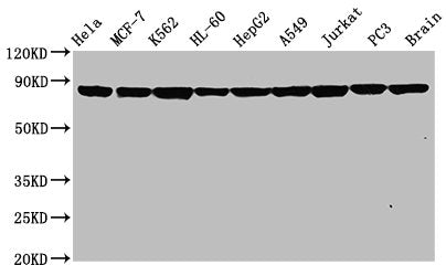Western Blot | Positive WB detected in: Hela whole cell lysate, MCF-7 whole cell lysate, K562 whole cell lysate, HL-60 whole cell lysate, HepG2 whole cell lysate, A549 whole cell lysate, Jurkat whole cell lysate, PC3 whole cell lysate, Rat brain tissue | All lanes: Hsp90 alpha antibody at 0.8μg/ml | Secondary | Goat polyclonal to rabbit IgG at 1/50000 dilution | Predicted band size: 85, 99 KDa | Observed band size: 85 KDaHSP90AA1 Recombinant Monoclonal Antibody