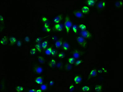 Immunofluorescence staining of Hela cells with HSP90AA1 Recombinant Monoclonal Antibody at 1:29, counter-stained with DAPI. The cells were fixed in 4% formaldehyde, permeabilized using 0.2% Triton X-100 and blocked in 10% normal Goat Serum. The cells were then incubated with the antibody overnight at 4℃. The secondary antibody was Alexa Fluor 488-congugated AffiniPure Goat Anti-Rabbit IgG (H+L).HSP90AA1 Recombinant Monoclonal Antibody