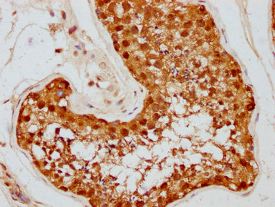 IHC image of HSP90AA1 Recombinant Monoclonal Antibody diluted at 1:87.5 and staining in paraffin-embedded human testis tissue performed on a Leica BondTM system. After dewaxing and hydration, antigen retrieval was mediated by high pressure in a citrate buffer (pH 6.0). Section was blocked with 10% normal goat serum 30min at RT. Then primary antibody (1% BSA) was incubated at 4℃ overnight. The primary is detected by a biotinylated secondary antibody and visualized using an HRP conjugated SP system.HSP90AA1 Recombinant Monoclonal Antibody