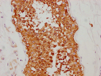 IHC image of HSP90AA1 Recombinant Monoclonal Antibody diluted at 1:190 and staining in paraffin-embedded human testis tissue performed on a Leica BondTM system. After dewaxing and hydration, antigen retrieval was mediated by high pressure in a citrate buffer (pH 6.0). Section was blocked with 10% normal goat serum 30min at RT. Then primary antibody (1% BSA) was incubated at 4℃ overnight. The primary is detected by a biotinylated secondary antibody and visualized using an HRP conjugated SP system.HSP90AA1 Recombinant Monoclonal Antibody
